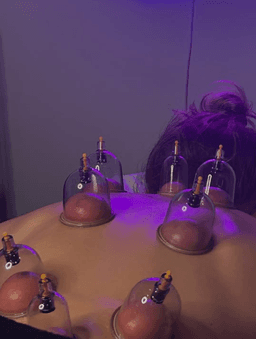 Qi Therapy [Cupping+ Body Gua Sha]
